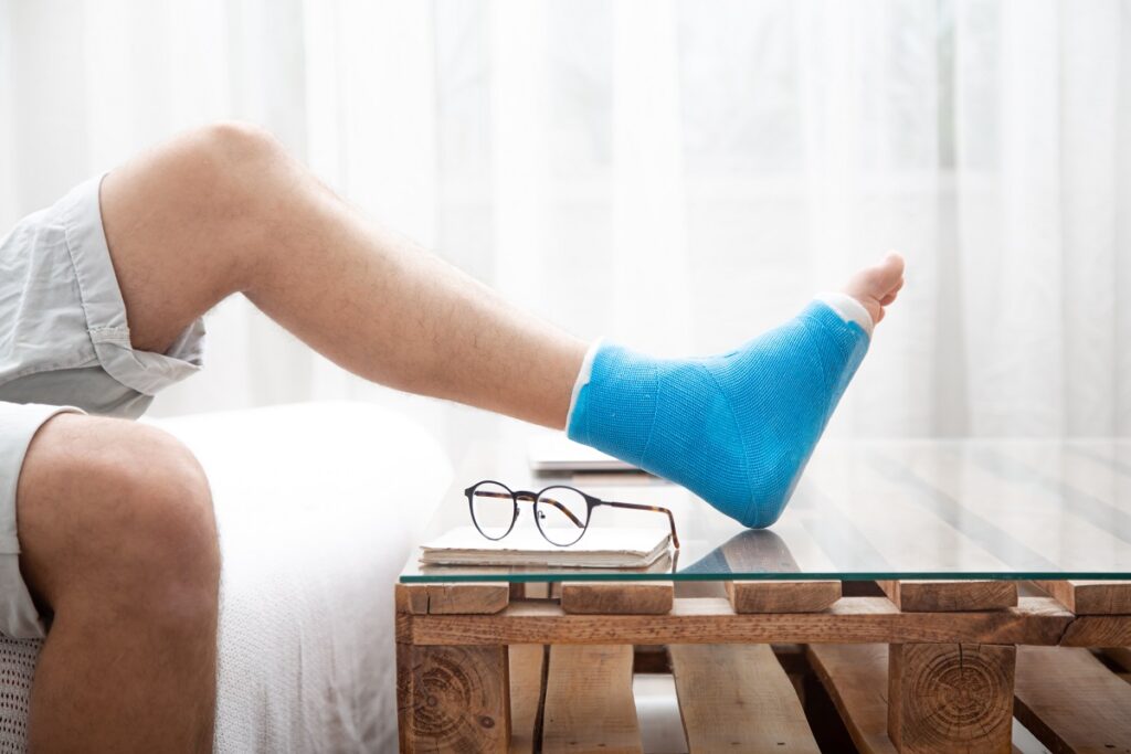 The leg of an injured person with a cast on their foot resting on a coffee table